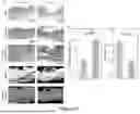 Fig. 45 - WIRELESS CLOSED-LOOP SMART BANDAGE FOR CHRONIC WOUND MANAGEMENT AND ACCELERATED TISSUE REGENERATION
