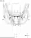 Fig. 12 - UNDER COWL