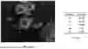 Fig. 14 - METHOD OF LEACHING METAL-CONTAINING MATERIALS