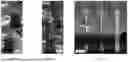 Fig. 14 - MULTI-LAYER HIGH-ASPECT RATIO X-RAY GRATING AND METHOD OF MANUFACTURE