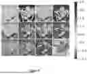 Fig. 07 - METHOD AND DATA PROCESSING SYSTEM FOR LOSSY IMAGE OR VIDEO ENCODING, TRANSMISSION AND DECODING