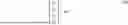Fig. 69 - METHOD AND DATA PROCESSING SYSTEM FOR LOSSY IMAGE OR VIDEO ENCODING, TRANSMISSION AND DECODING