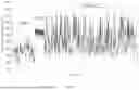 Fig. 09 - ARTIFICIAL INTELLIGENCE (AI) BASED SELECTIVE SEQUENCING PLATFORM USING OXFORD NANOPORE TECHNOLOGY (ONT)