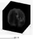 Fig. 03 - PRECISION FUNCTIONAL MAPPING (PFM) TO PERSONALIZE NEUROMODULATION IN PSYCHIATRIC AND NEUROLOGICAL APPLICATIONS