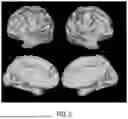 Fig. 07 - PRECISION FUNCTIONAL MAPPING (PFM) TO PERSONALIZE NEUROMODULATION IN PSYCHIATRIC AND NEUROLOGICAL APPLICATIONS