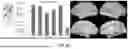 Fig. 10 - PRECISION FUNCTIONAL MAPPING (PFM) TO PERSONALIZE NEUROMODULATION IN PSYCHIATRIC AND NEUROLOGICAL APPLICATIONS