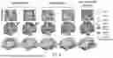 Fig. 12 - PRECISION FUNCTIONAL MAPPING (PFM) TO PERSONALIZE NEUROMODULATION IN PSYCHIATRIC AND NEUROLOGICAL APPLICATIONS