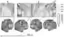 Fig. 13 - PRECISION FUNCTIONAL MAPPING (PFM) TO PERSONALIZE NEUROMODULATION IN PSYCHIATRIC AND NEUROLOGICAL APPLICATIONS