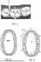 Fig. 02 - GUM DISEASE EXAMINATION