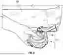 Fig. 03 - INFLATABLE SLEEP ANGLE ADJUSTMENT DEVICE