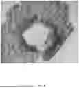 Fig. 09 - SUTURE METHODS