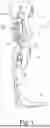 Fig. 02 - ORTHOTIC OR PROSTHETIC JOINT DEVICE, AND METHOD FOR CONTROLLING SAME