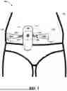 Fig. 02 - MEDICAL-DEVICE TENSIONING SYSTEMS, METHODS, AND KITS