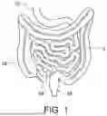 Fig. 02 - IMPROVED SYSTEM FOR GASTROINTESTINAL HEALTH
