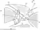 Fig. 01 - SURGICAL DEVICE FOR SUCTION, IRRIGATION, AND RETRACTING TISSUE