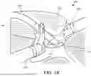 Fig. 02 - SURGICAL DEVICE FOR SUCTION, IRRIGATION, AND RETRACTING TISSUE