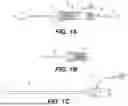Fig. 02 - EXPANDABLE SHEATH WITH LONGITUDINALLY EXTENDING REINFORCING MEMBERS