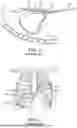 Fig. 02 - PERICARDIAL ACCESS AND ANCHOR SYSTEMS