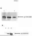 Fig. 02 - CYSTEINE PROTEASE