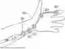 Fig. 01 - QUANTITATIVE NEUROMUSCULATURE BLOCKADE SENSING SYSTEMS AND METHODS