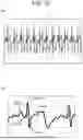 Fig. 16 - BIOLOGICAL INFORMATION ACQUISITION SYSTEM AND ELECTRODE SHEET