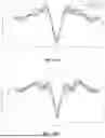 Fig. 08 - DISSECTING BETA WAVEFORMS USING CONVOLUTIONAL DICTIONARY LEARNING ACROSS SENSORY PERCEPTION, AGING, AND DISEASE