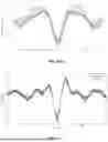 Fig. 09 - DISSECTING BETA WAVEFORMS USING CONVOLUTIONAL DICTIONARY LEARNING ACROSS SENSORY PERCEPTION, AGING, AND DISEASE