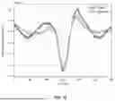 Fig. 10 - DISSECTING BETA WAVEFORMS USING CONVOLUTIONAL DICTIONARY LEARNING ACROSS SENSORY PERCEPTION, AGING, AND DISEASE
