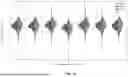 Fig. 13 - DISSECTING BETA WAVEFORMS USING CONVOLUTIONAL DICTIONARY LEARNING ACROSS SENSORY PERCEPTION, AGING, AND DISEASE