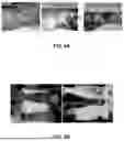 Fig. 13 - SYSTEMS, DEVICES, AND METHODS FOR THERMAL IMAGING