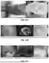 Fig. 17 - SYSTEMS, DEVICES, AND METHODS FOR THERMAL IMAGING