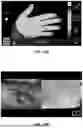Fig. 19 - SYSTEMS, DEVICES, AND METHODS FOR THERMAL IMAGING