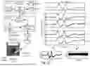 Fig. 35 - SENSOR ARRAYS, METHOD FOR OPERATING A SENSOR ARRAY AND A COMPUTER PROGRAM FOR PERFORMING A METHOD FOR OPERATING A SENSOR ARRAY