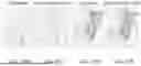 Fig. 33 - Methods And Devices For Real-Time Word And Speech Decoding From Neural Activity