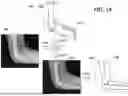 Fig. 09 - OBJECT VISUALISATION IN X-RAY IMAGING