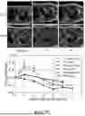 Fig. 35 - MULTI-MODAL, MULTI-RESOLUTION DEEP LEARNING NEURAL NETWORKS FOR SEGMENTATION, OUTCOMES PREDICTION AND LONGITUDINAL RESPONSE MONITORING TO IMMUNOTHERAPY AND RADIOTHERAPY