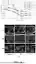 Fig. 49 - MULTI-MODAL, MULTI-RESOLUTION DEEP LEARNING NEURAL NETWORKS FOR SEGMENTATION, OUTCOMES PREDICTION AND LONGITUDINAL RESPONSE MONITORING TO IMMUNOTHERAPY AND RADIOTHERAPY
