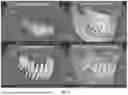 Fig. 08 - METHODS AND APPARATUSES FOR HYBRID CONE BEAM COMPUTED TOMOGRAPHIC AND INTRAORAL SCAN IMAGE MODELING