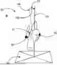 Fig. 01 - METHOD FOR PROVIDING GUIDANCE DATA IN AN X-RAY SYSTEM