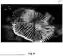 Fig. 07 - ULTRASOUND IMAGING FOR VISUALIZATION AND QUANTIFICATION OF MITRAL REGURGITATION
