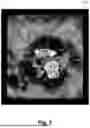 Fig. 08 - ULTRASOUND IMAGING FOR VISUALIZATION AND QUANTIFICATION OF MITRAL REGURGITATION