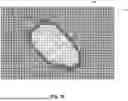 Fig. 22 - ULTRASOUND IMAGING FOR VISUALIZATION AND QUANTIFICATION OF MITRAL REGURGITATION