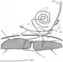Fig. 35 - SYSTEMS, DEVICES, AND METHODS FOR CLOSING AN ABDOMINAL WALL DEFECT