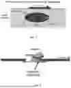 Fig. 02 - IMPLANTABLE DEVICES, SYSTEMS AND METHODS FOR CLOSING APERTURE