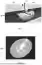 Fig. 04 - IMPLANTABLE DEVICES, SYSTEMS AND METHODS FOR CLOSING APERTURE