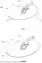 Fig. 05 - IMPLANTABLE DEVICES, SYSTEMS AND METHODS FOR CLOSING APERTURE