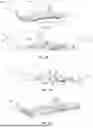 Fig. 16 - IMPLANTABLE DEVICES, SYSTEMS AND METHODS FOR CLOSING APERTURE