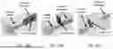 Fig. 23 - IMPLANTABLE DEVICES, SYSTEMS AND METHODS FOR CLOSING APERTURE