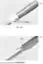 Fig. 35 - IMPLANTABLE DEVICES, SYSTEMS AND METHODS FOR CLOSING APERTURE