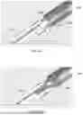Fig. 41 - IMPLANTABLE DEVICES, SYSTEMS AND METHODS FOR CLOSING APERTURE